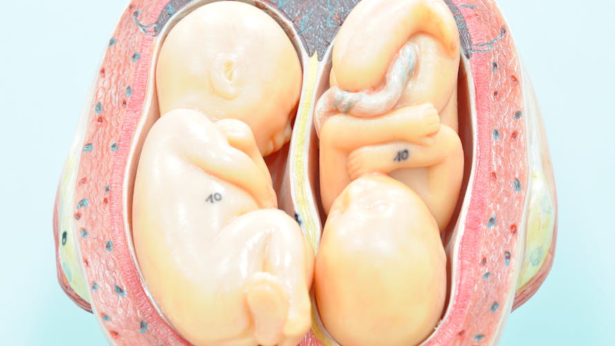 Schéma de foetus de jumeaux.