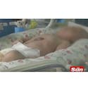 En Chine, un bébé est né avec le cœur en dehors de la  poitrine