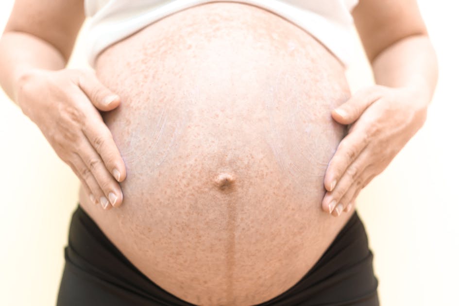 Аллергия на животе у беременной