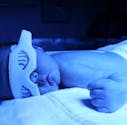 Nouveau-né : la lumière bleue contre la jaunisse
  augmenterait le risque de cancer pédiatrique