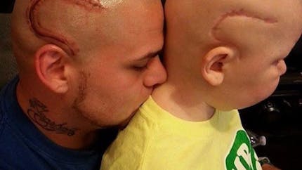 Par amour pour son fils, il se tatoue la même
  cicatrice