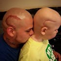 Par amour pour son fils, il se tatoue la même
  cicatrice