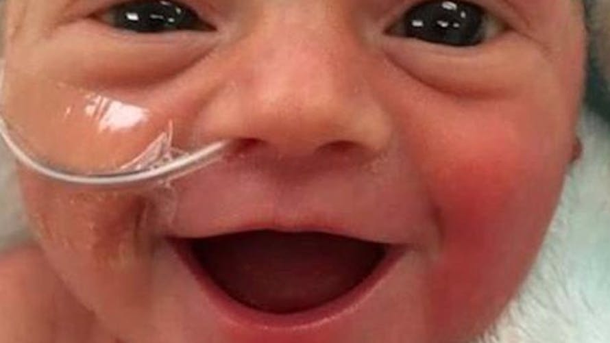 Le sourire d’un bébé prématuré émeut le web