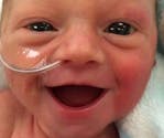 Le sourire d’un bébé prématuré émeut le web