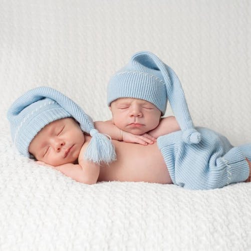 Un bébé naît avec la tête de son jumeau accrochée à son
  estomac