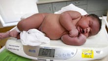 Étonnant : naissance d'un bébé de 6 kg ! (PHOTO)