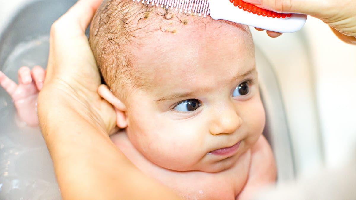 Bébé a des croûtes de lait dans les cheveux