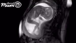 Un bébé étire ses jambes dans le ventre de sa mère (VIDEO)