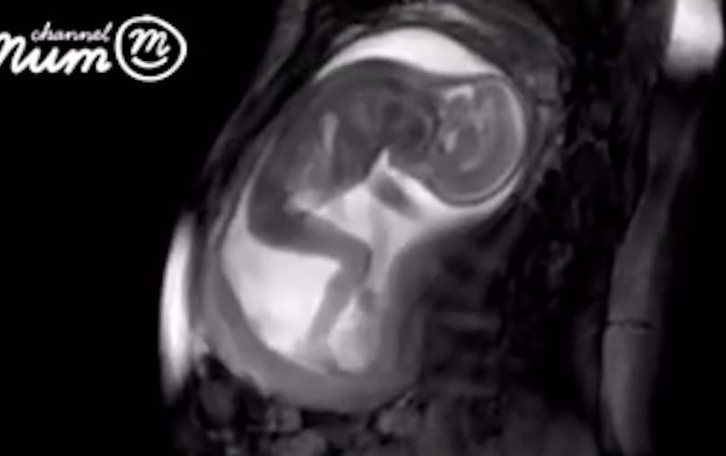 Un Bebe Etire Ses Jambes Dans Le Ventre De Sa Mere Video Parents Fr Un Bebe Etire Ses Jambes Dans Le Ventre De Sa Mere Video Parents Fr