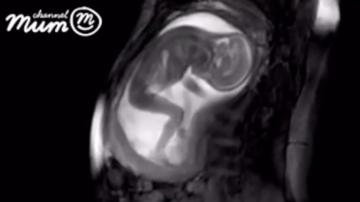 Un Bebe Etire Ses Jambes Dans Le Ventre De Sa Mere Video Parents Fr Un Bebe Etire Ses Jambes Dans Le Ventre De Sa Mere Video Parents Fr