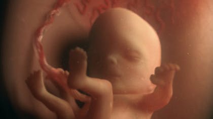 11 Semaine De Grossesse 13 Sa De Grossesse 11eme Semaine Parents Fr 11 Semaine De Grossesse 13 Sa De Grossesse 11eme Semaine Parents Fr