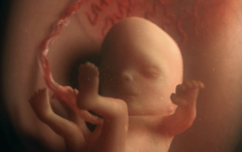11 Semaine De Grossesse 13 Sa De Grossesse 11eme Semaine Parents Fr 11 Semaine De Grossesse 13 Sa De Grossesse 11eme Semaine Parents Fr