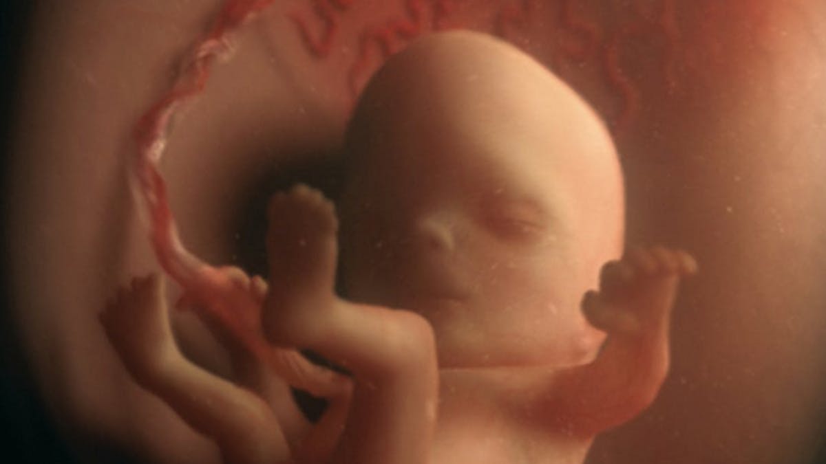 11 Semaine De Grossesse 13 Sa De Grossesse 11eme Semaine Parents Fr 11 Semaine De Grossesse 13 Sa De Grossesse 11eme Semaine Parents Fr