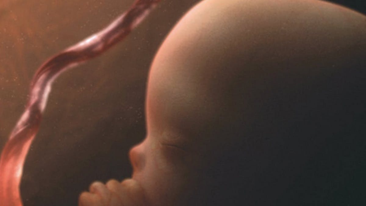Semaine 13 De Grossesse 15 Sa De Grossesse 13eme Semaine Parents Fr Semaine 13 De Grossesse 15 Sa De Grossesse 13eme Semaine Parents Fr