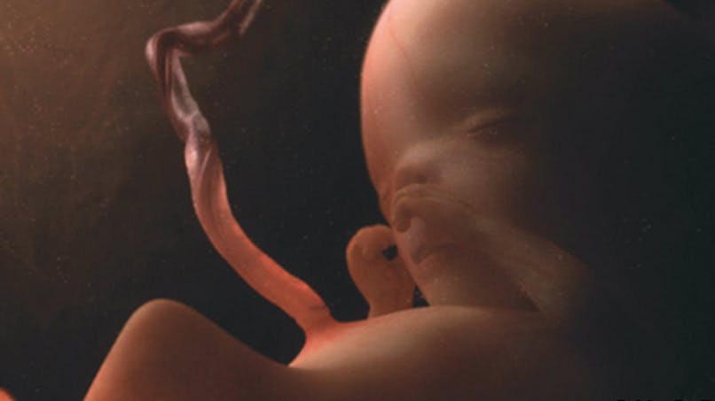 Semaine 14 De Grossesse 16 Sa De Grossesse 14eme Semaine Parents Fr Semaine 14 De Grossesse 16 Sa De Grossesse 14eme Semaine Parents Fr