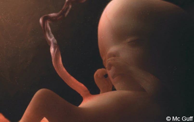 Semaine 14 De Grossesse 16 Sa De Grossesse 14eme Semaine Parents Fr Semaine 14 De Grossesse 16 Sa De Grossesse 14eme Semaine Parents Fr