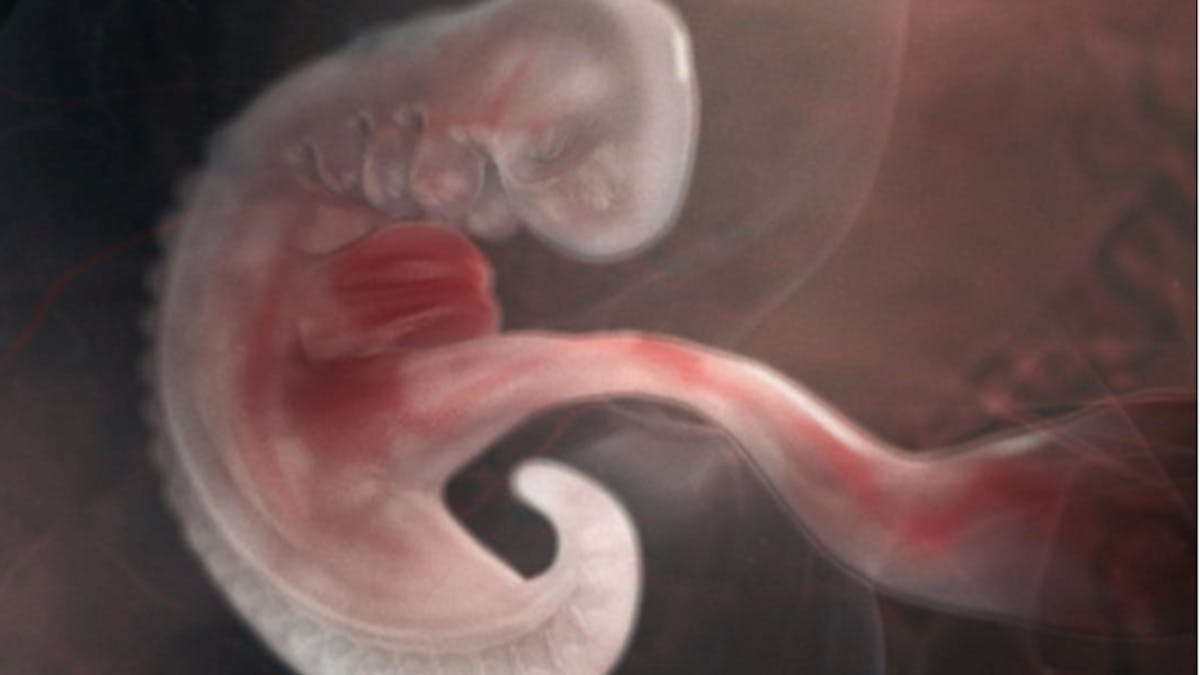 3e Semaine De Grossesse 3 Semaines De Grossesse 5 Sa Parents Fr 3e Semaine De Grossesse 3 Semaines De Grossesse 5 Sa Parents Fr