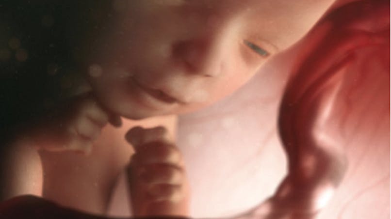 Semaine 19 De Grossesse 19 Semaines De Grossesse 21 Sa Parents Fr Semaine 19 De Grossesse 19 Semaines De Grossesse 21 Sa Parents Fr