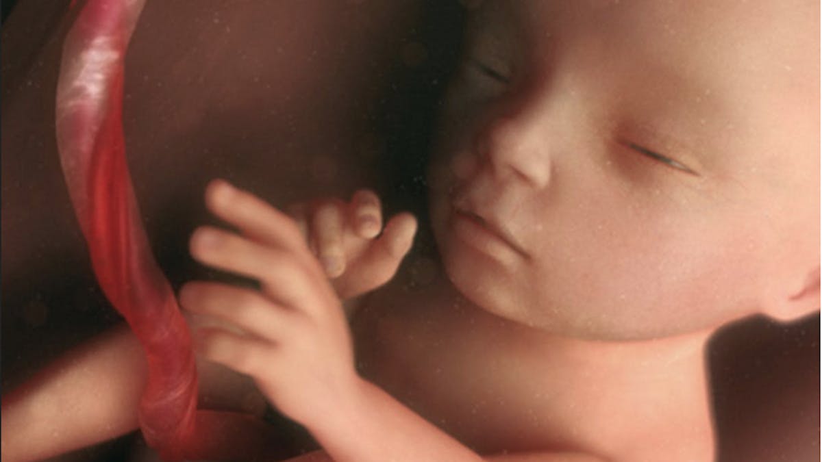 Semaine 18 De Grossesse Sa De Grossesse eme Semaine Parents Fr Semaine 18 De Grossesse Sa De Grossesse eme Semaine Parents Fr