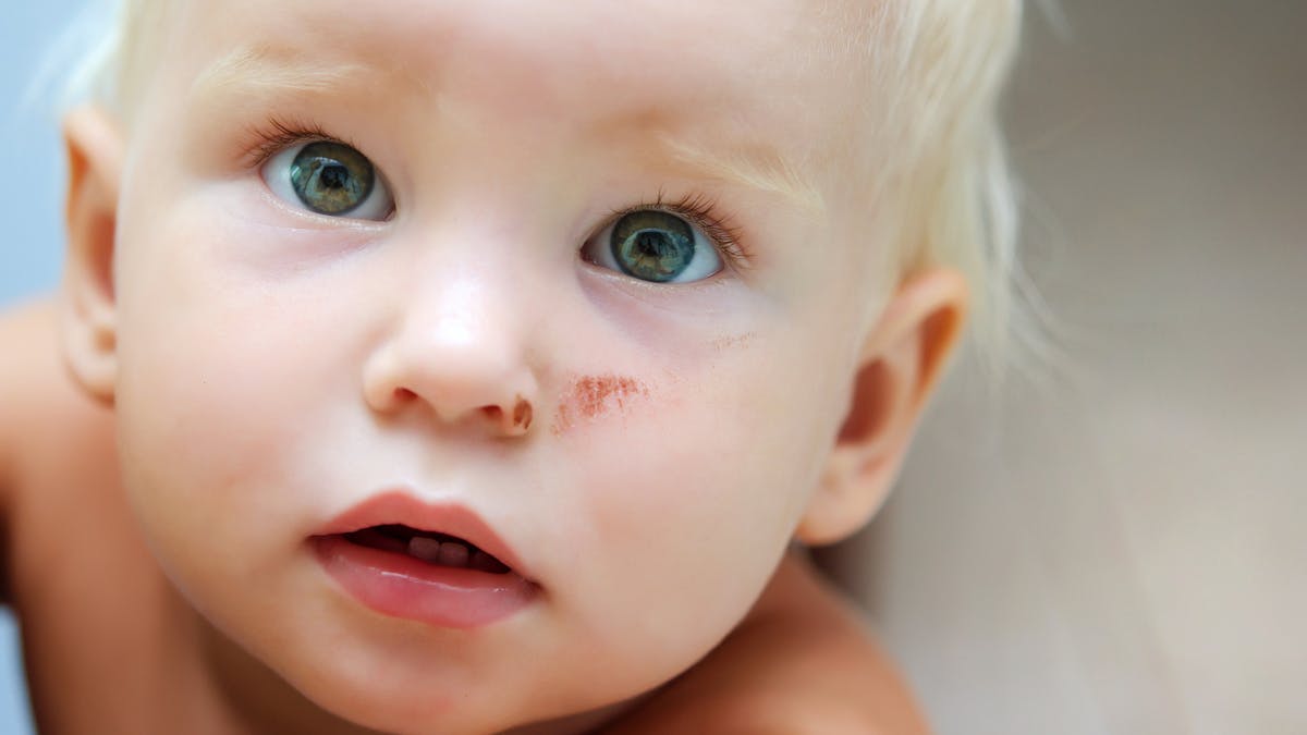 Soigner Les Plaies Et Bosses De Bebe Parents Fr Soigner Les Plaies Et Bosses De Bebe Parents Fr