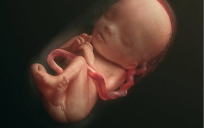 Semaine 21 De Grossesse 23 Sa De Grossesse 21eme Semaine Parents Fr Semaine 21 De Grossesse 23 Sa De Grossesse 21eme Semaine Parents Fr