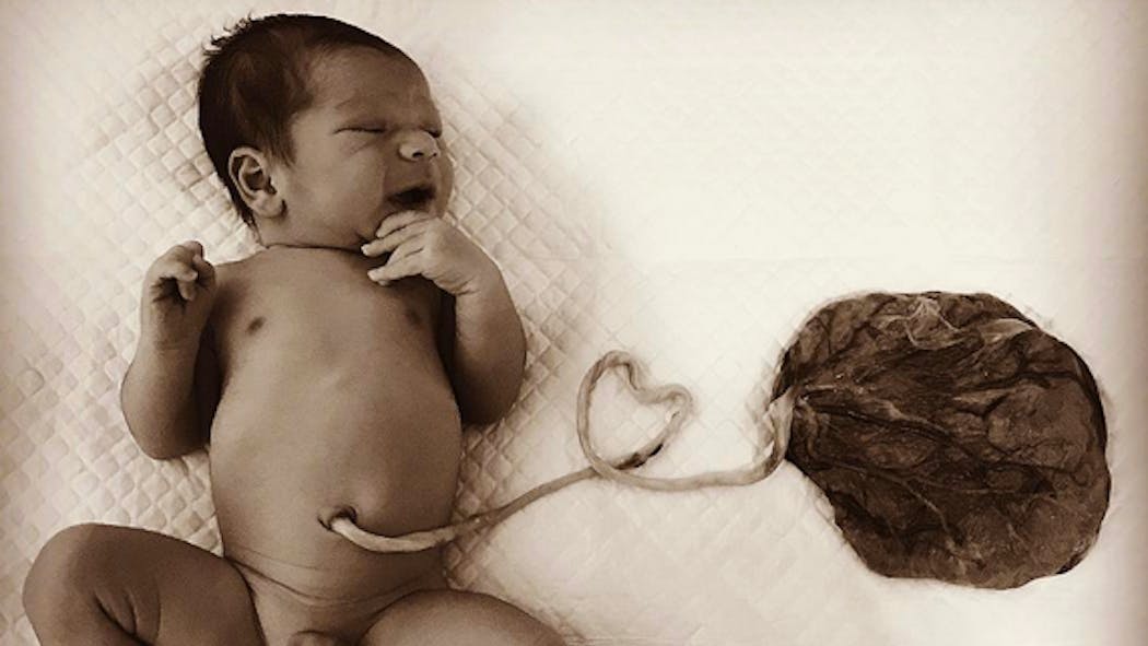Les Bebes Lotus Cette Nouvelle Tendance Est Elle Dangereuse Parents Fr Les Bebes Lotus Cette Nouvelle Tendance Est Elle Dangereuse Parents Fr