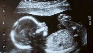 Le fœtus voit-il les visages ? 