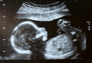 Le fœtus voit-il les visages ?
