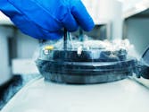 L'Académie de médecine se prononce pour la conservation des ovocytes à des fins non médicales