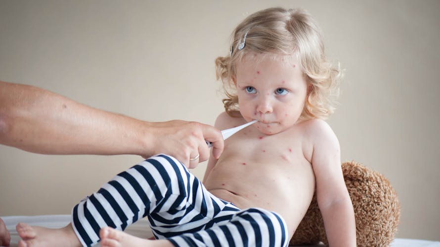 Varicelle Rubeole Rougeole Maladies Avec Fievre Et Boutons Parents Fr Varicelle Rubeole Rougeole Maladies Avec Fievre Et Boutons Parents Fr