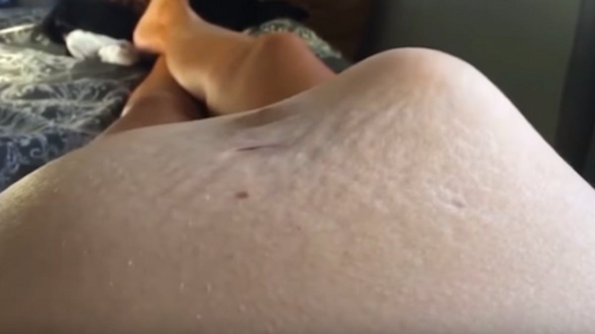 Insolite Un Bebe Deforme Le Ventre De Sa Mere Avec Ses Coups Video Parents Fr Insolite Un Bebe Deforme Le Ventre De Sa Mere Avec Ses Coups Video Parents Fr