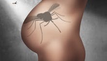 Femme enceinte : bientôt une solution contre le virus Zika
