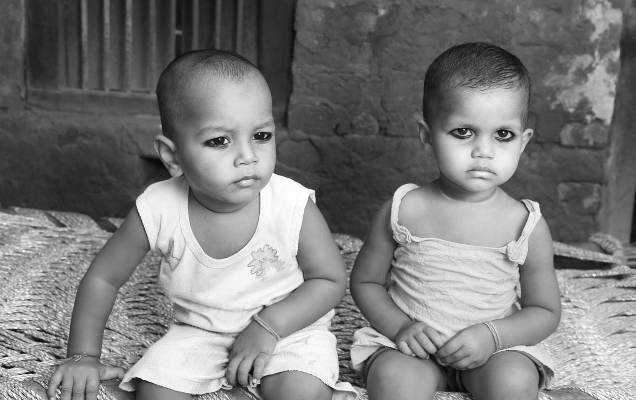 Des Siamois Relies Par La Tete Operes Avec Succes En Inde Parents Fr Des Siamois Relies Par La Tete Operes Avec Succes En Inde Parents Fr