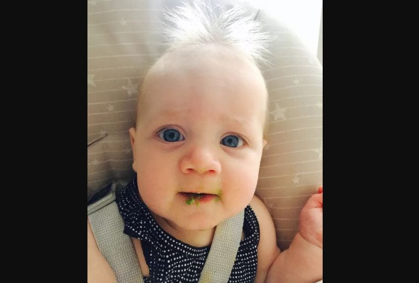 L Incroyable Chevelure D Un Bebe Atteint Du Syndrome Des Cheveux Incoiffables Images Parents Fr L Incroyable Chevelure D Un Bebe Atteint Du Syndrome Des Cheveux Incoiffables Images Parents Fr