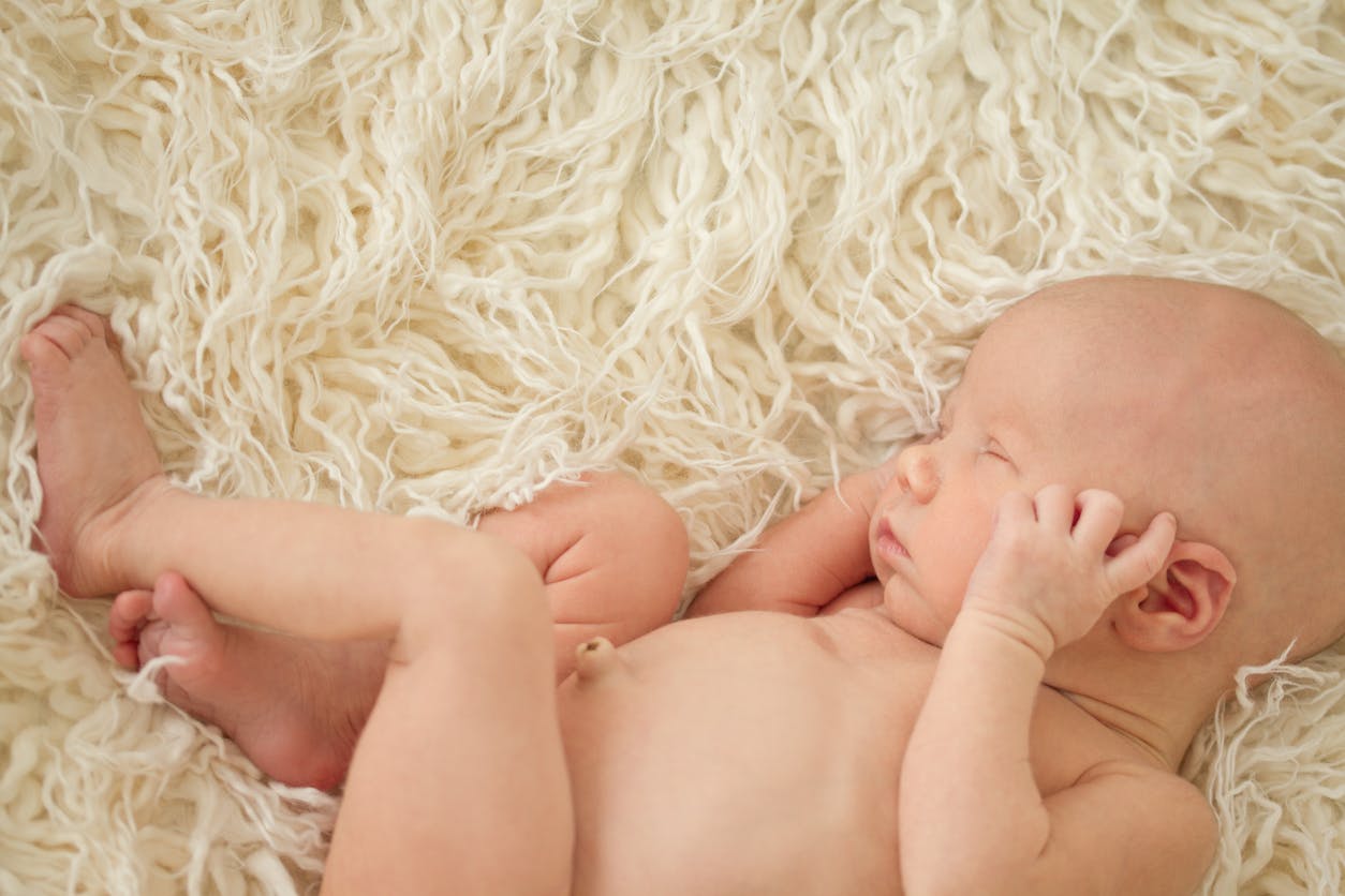 Tout Savoir Sur La Hernie Ombilicale Chez Le Bebe Parents Fr Tout Savoir Sur La Hernie Ombilicale Chez Le Bebe Parents Fr
