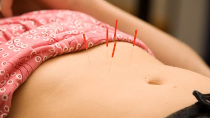 FIV : l'acupuncture boosterait les chances de succès