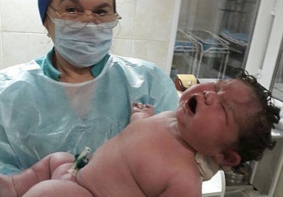 Une Femme Accouche D Un Bebe De 6 3 Kg Sans Peridurale Parents Fr Une Femme Accouche D Un Bebe De 6 3 Kg Sans Peridurale Parents Fr