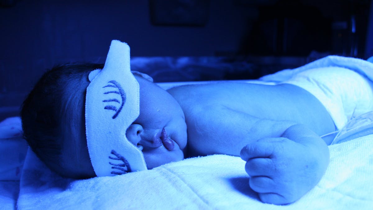 bébé jaunisse sous lumière bleue