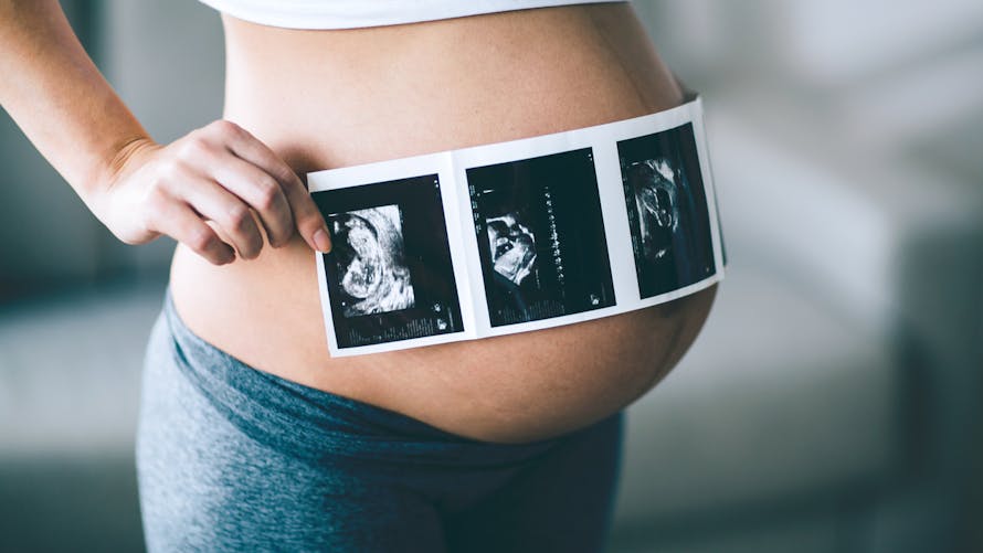 femme enceinte échographie