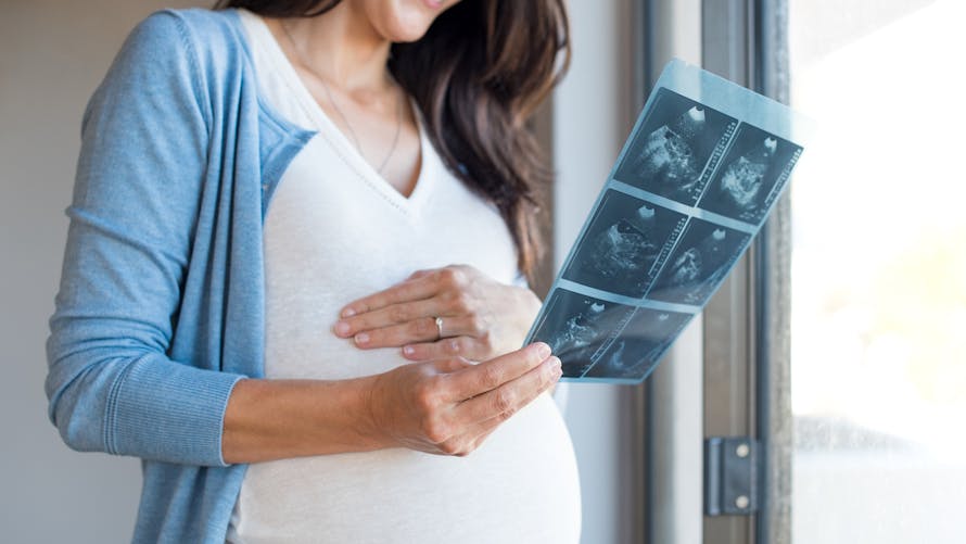 Une femme enceinte regarde son échographie du deuxième trimestre.