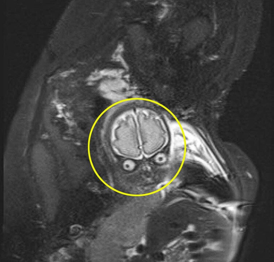 Grossesse Elle Fait Une Irm Et L Image Du Cerveau De Son Bebe Est Surprenante Parents Fr Grossesse Elle Fait Une Irm Et L Image Du Cerveau De Son Bebe Est Surprenante Parents Fr