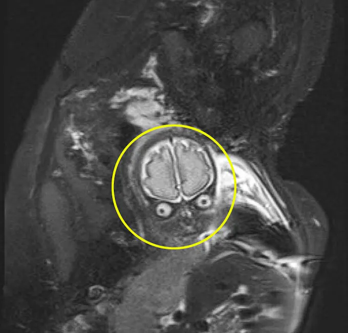 Avoir Images Grossesse Elle Fait Une Irm Et L Image Du Cerveau De Son Bebe dernière salutations