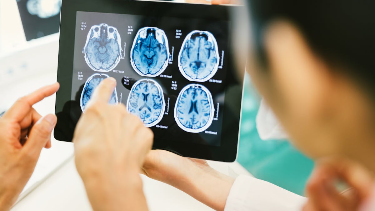 Grossesse Elle Fait Une Irm Et L Image Du Cerveau De Son Bebe Est Surprenante Parents Fr Grossesse Elle Fait Une Irm Et L Image Du Cerveau De Son Bebe Est Surprenante Parents Fr