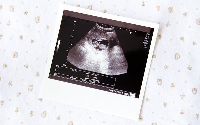 7 Semaine De Grossesse 9 Sa De Grossesse 7eme Semaine Parents Fr 7 Semaine De Grossesse 9 Sa De Grossesse 7eme Semaine Parents Fr