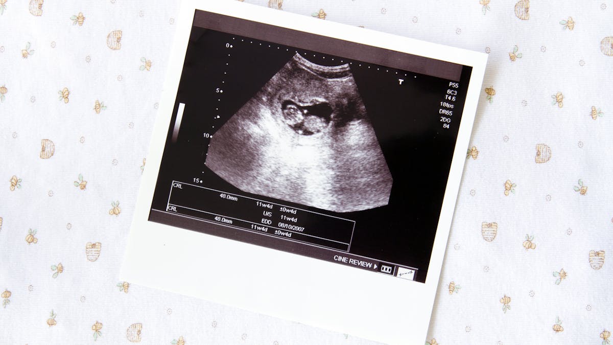 7 Semaine De Grossesse 9 Sa De Grossesse 7eme Semaine Parents Fr 7 Semaine De Grossesse 9 Sa De Grossesse 7eme Semaine Parents Fr