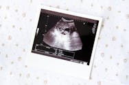 Semaine 7 de grossesse (9 SA)