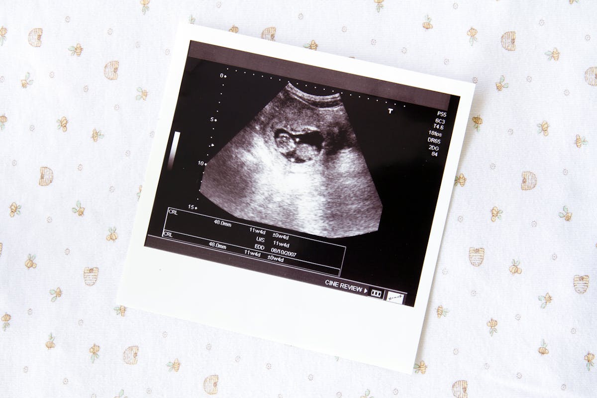 11 semaines de grossesse : À quoi s'attendre