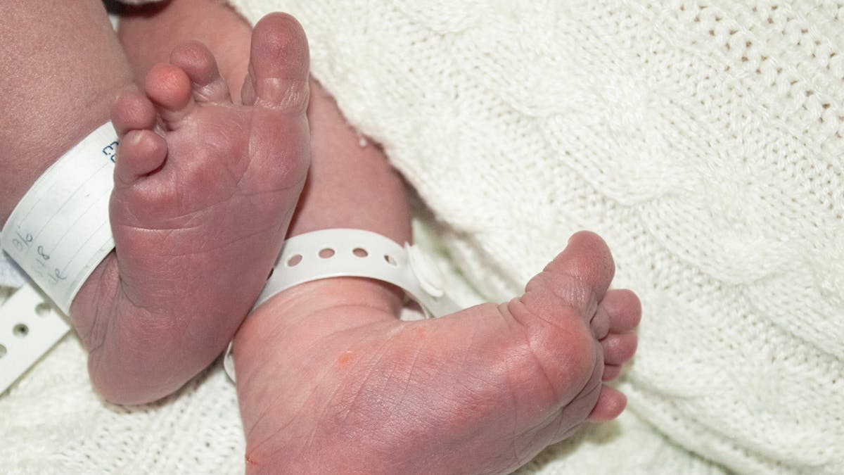 Ain Un Nombre Anormal De Bebes Nes Sans Bras Ou Sans Main Inquiete Parents Fr Ain Un Nombre Anormal De Bebes Nes Sans Bras Ou Sans Main Inquiete Parents Fr
