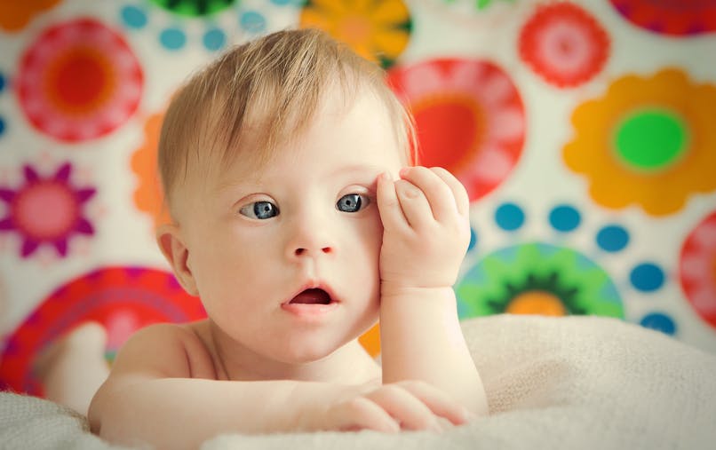 Trisomie Definition Et Cause De Cette Maladie Genetique Parents Fr Trisomie Definition Et Cause De Cette Maladie Genetique Parents Fr