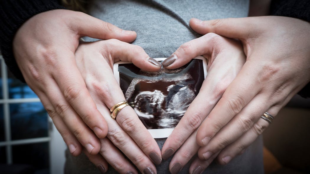 Trisomie On Lui Conseille D Avorter Parce Que Son Bebe Serait Atteint De Trisomie 21 Elle Accouche D Un Bebe Non Trisomique Parents Fr Trisomie On Lui Conseille D Avorter Parce Que Son Bebe Serait Atteint De Trisomie 21 Elle Accouche D Un Bebe Non Trisomique Parents Fr